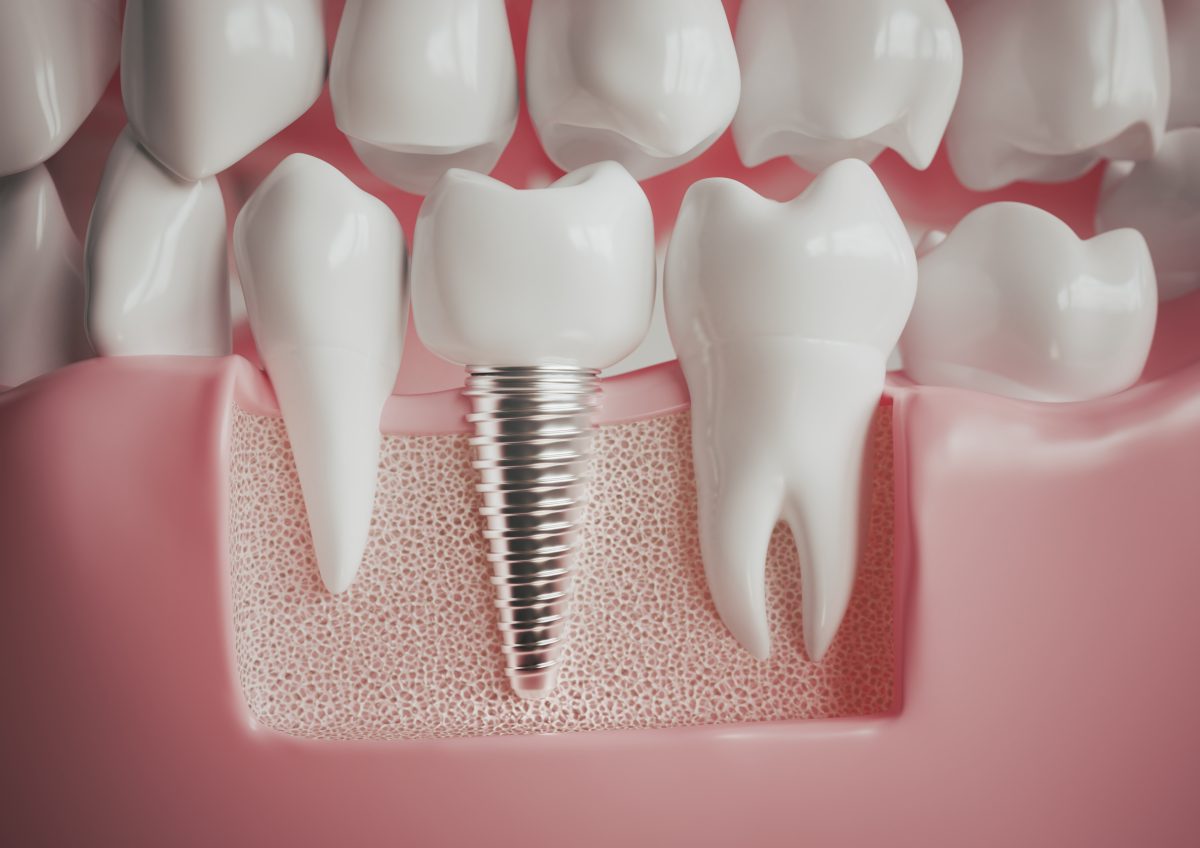 iStock-1440203520-1200x848.jpg